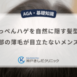 てっぺんハゲを自然に隠す髪型！頭頂部の薄毛が目立たないメンズヘア