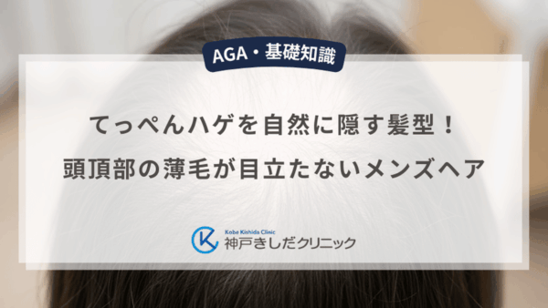 てっぺんハゲを自然に隠す髪型！頭頂部の薄毛が目立たないメンズヘア