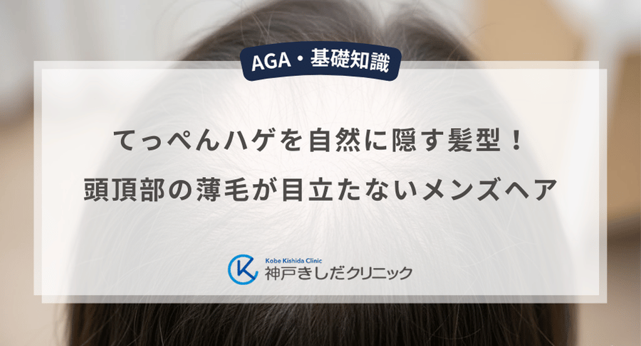 てっぺんハゲを自然に隠す髪型!頭頂部の薄毛が目立たないメンズヘア