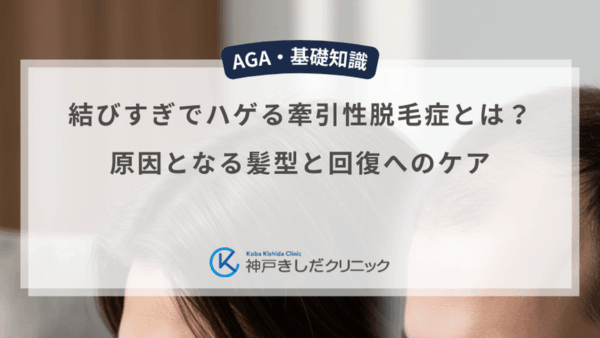 結びすぎでハゲる牽引性脱毛症とは？原因となる髪型と回復へのケア