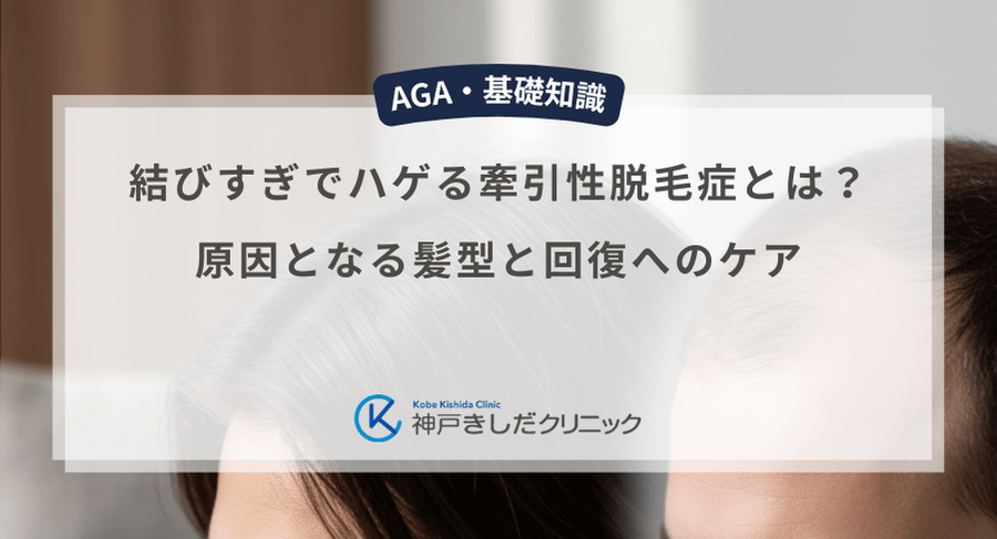 結びすぎでハゲる牽引性脱毛症とは？原因となる髪型と回復へのケア