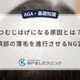 つむじはげになる原因とは？頭頂部の薄毛を進行させるNG習慣