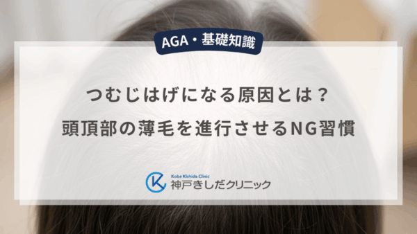 つむじはげになる原因とは？頭頂部の薄毛を進行させるNG習慣