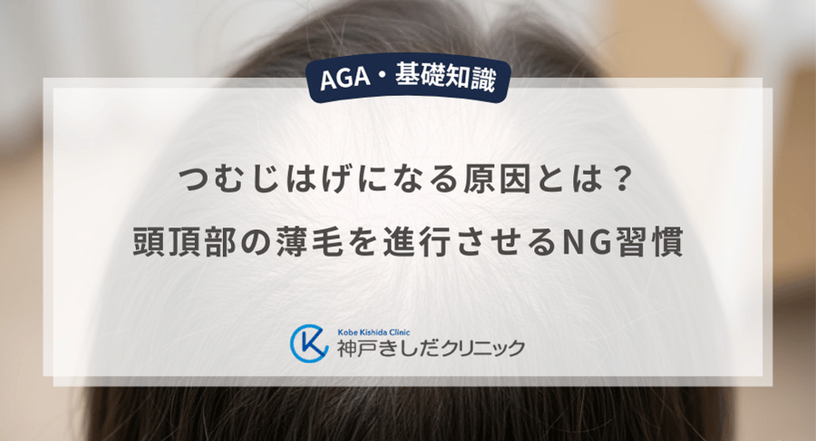 つむじはげになる原因とは?頭頂部の薄毛を進行させるNG習慣