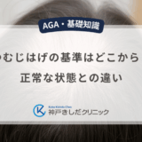 つむじはげの基準はどこから？正常な状態との違い