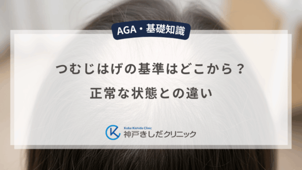 つむじはげの基準はどこから？正常な状態との違い
