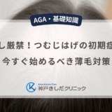 見逃し厳禁！つむじはげの初期症状と今すぐ始めるべき薄毛対策