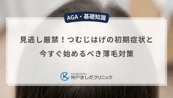 見逃し厳禁！つむじはげの初期症状と今すぐ始めるべき薄毛対策