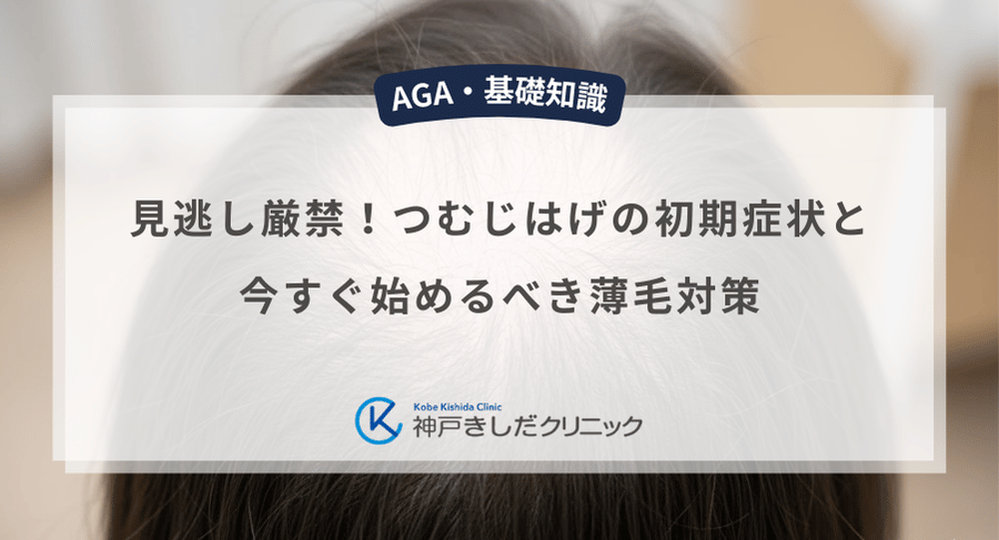 見逃し厳禁！つむじはげの初期症状と今すぐ始めるべき薄毛対策