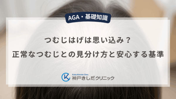 つむじはげは思い込み？正常なつむじとの見分け方と安心する基準