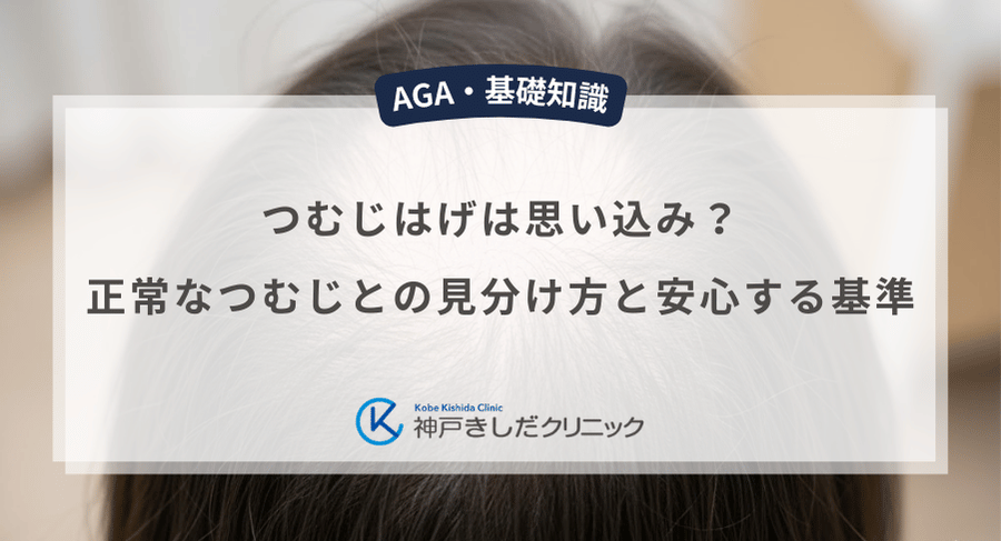 つむじはげは思い込み?正常なつむじとの見分け方と安心する基準