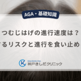 つむじはげの進行速度は？放置するリスクと進行を食い止める対策