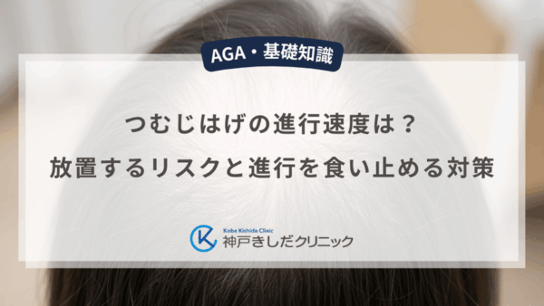 つむじはげの進行速度は？放置するリスクと進行を食い止める対策