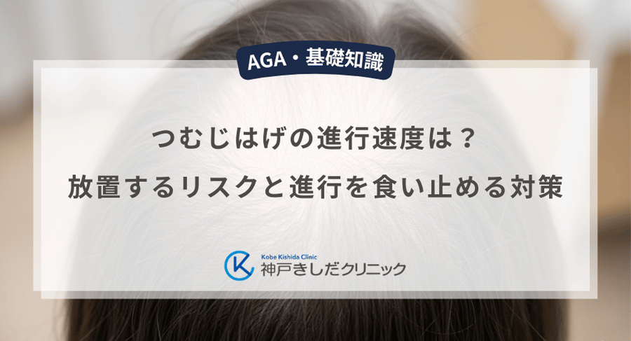 つむじはげの進行速度は？放置するリスクと進行を食い止める対策