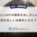 つむじはげの確実な治し方とは？原因別の正しい治療法とセルフケア