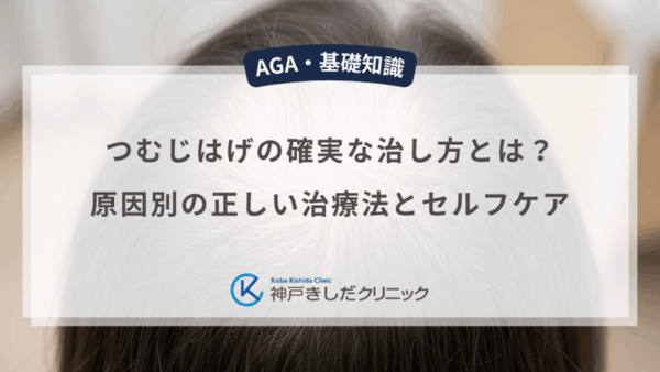 つむじはげの確実な治し方とは？原因別の正しい治療法とセルフケア