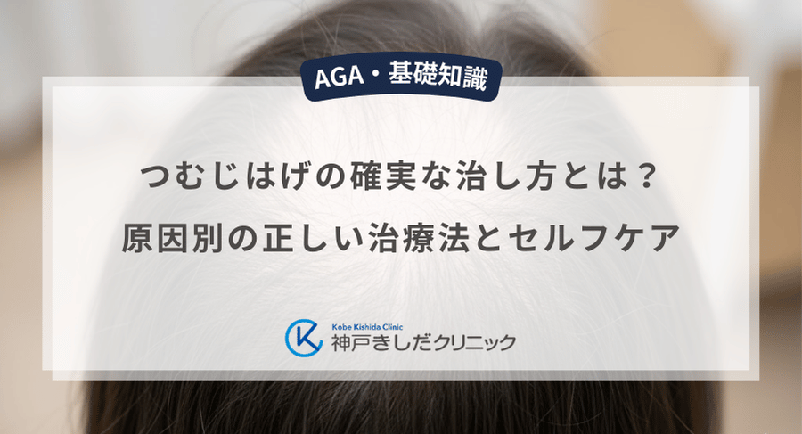 つむじはげの確実な治し方とは?原因別の正しい治療法とセルフケア