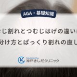 つむじ割れとつむじはげの違いは？見分け方とぱっくり割れの直し方