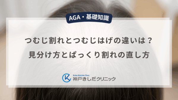つむじ割れとつむじはげの違いは？見分け方とぱっくり割れの直し方