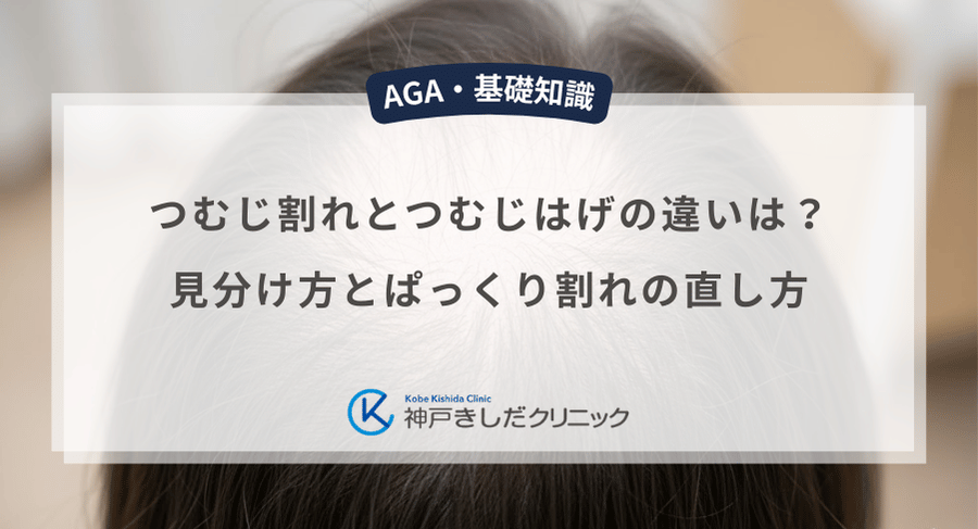 つむじ割れとつむじはげの違いは?見分け方とぱっくり割れの直し方