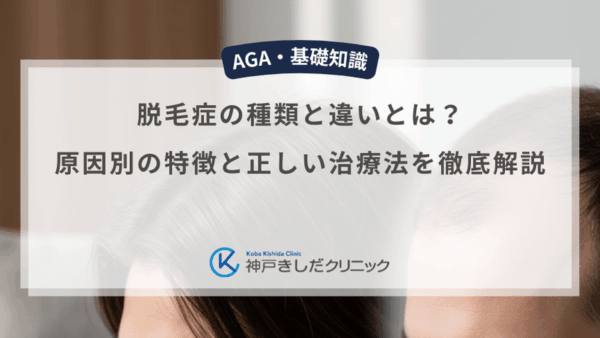 脱毛症の種類と違いとは？原因別の特徴と正しい治療法を徹底解説