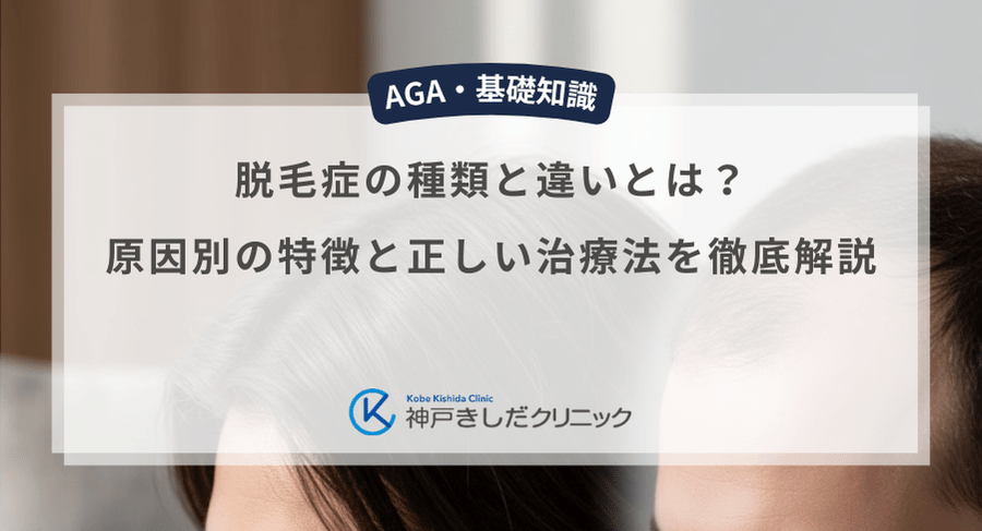 脱毛症の種類と違いとは？原因別の特徴と正しい治療法を徹底解説