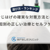 つむじはげの確実な対策方法とは？原因別の正しい治療とセルフケア