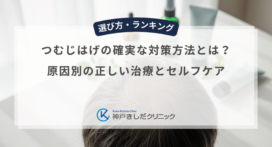 つむじはげの確実な対策方法とは？原因別の正しい治療とセルフケア