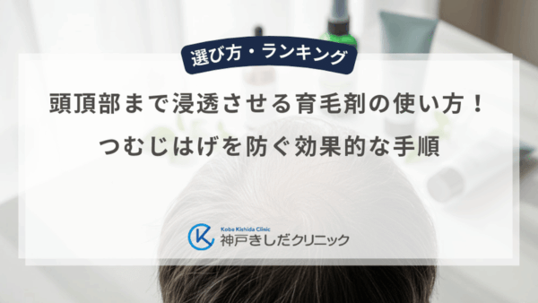 頭頂部まで浸透させる育毛剤の使い方！つむじはげを防ぐ効果的な手順