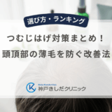 つむじはげ対策まとめ！頭頂部の薄毛を防ぐ改善法