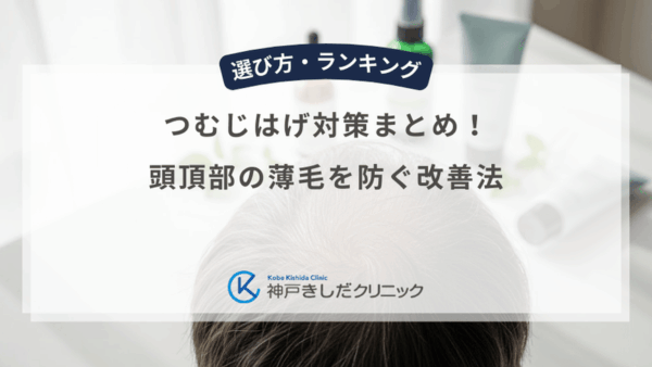 つむじはげ対策まとめ！頭頂部の薄毛を防ぐ改善法