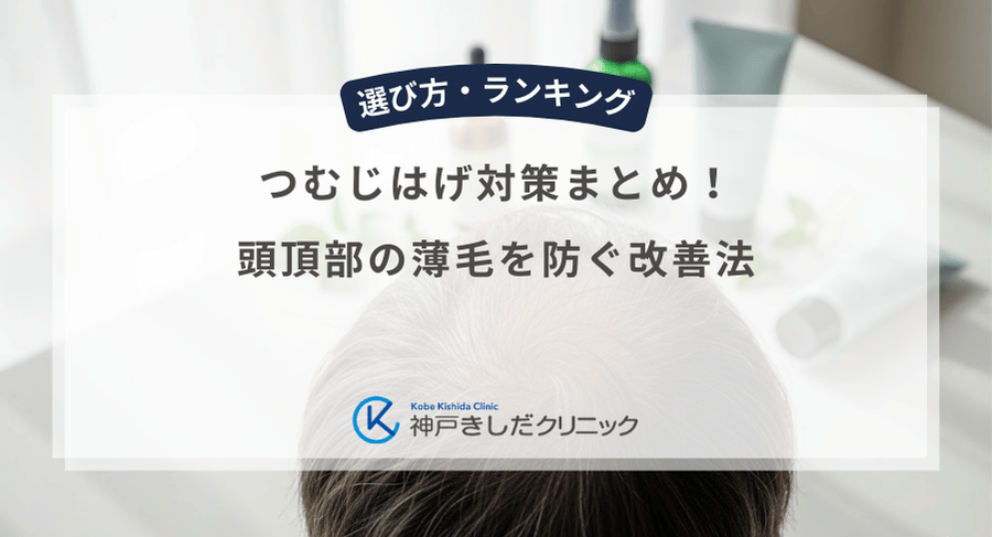 つむじはげ対策まとめ！頭頂部の薄毛を防ぐ改善法