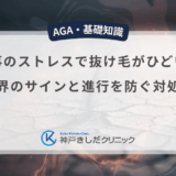 仕事のストレスで抜け毛がひどい！限界のサインと進行を防ぐ対処法