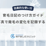 育毛日記のつけ方ガイド｜スマホ写真で発毛の変化を記録するメリット