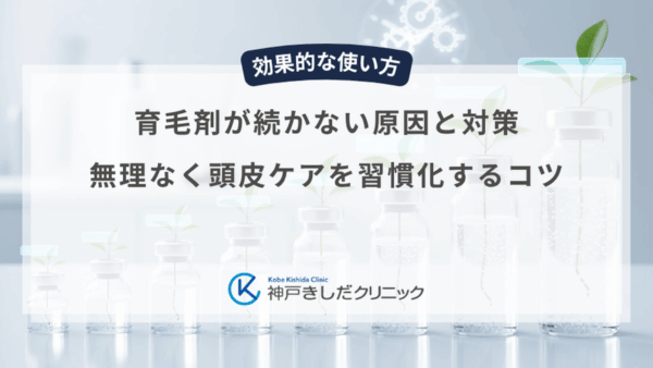 育毛剤が続かない原因と対策｜無理なく頭皮ケアを習慣化するコツ