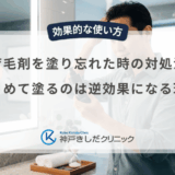 育毛剤を塗り忘れた時の対処法｜まとめて塗るのは逆効果になる理由