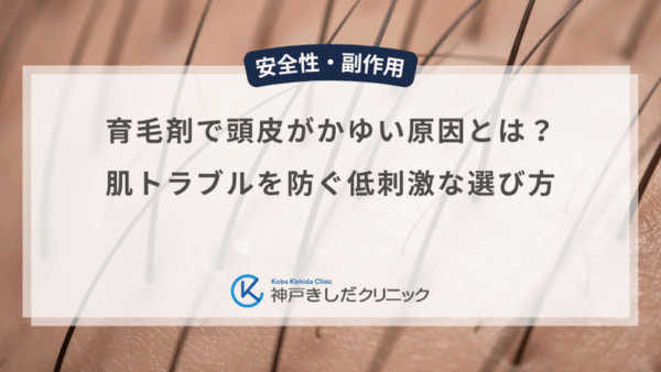 育毛剤で頭皮がかゆい原因とは？肌トラブルを防ぐ低刺激な選び方