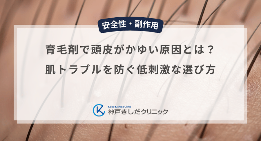 育毛剤で頭皮がかゆい原因とは？肌トラブルを防ぐ低刺激な選び方