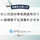 つむじ付近の育毛剤塗布ガイド｜見えない後頭部でも液垂れさせない方法