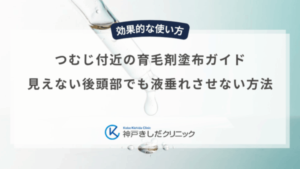 つむじ付近の育毛剤塗布ガイド｜見えない後頭部でも液垂れさせない方法