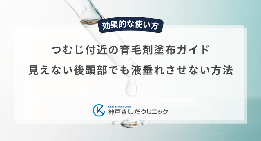 つむじ付近の育毛剤塗布ガイド｜見えない後頭部でも液垂れさせない方法