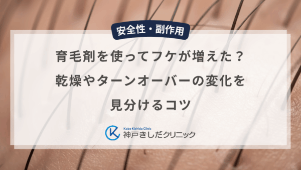 育毛剤を使ってフケが増えた？乾燥やターンオーバーの変化を見分けるコツ