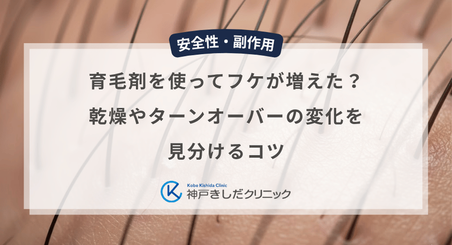 育毛剤を使ってフケが増えた？乾燥やターンオーバーの変化を見分けるコツ