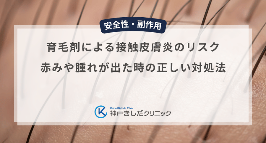 育毛剤による接触皮膚炎のリスク|赤みや腫れが出た時の正しい対処法