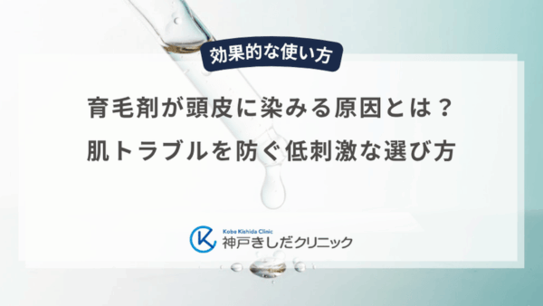 育毛剤が頭皮に染みる原因とは？肌トラブルを防ぐ低刺激な選び方