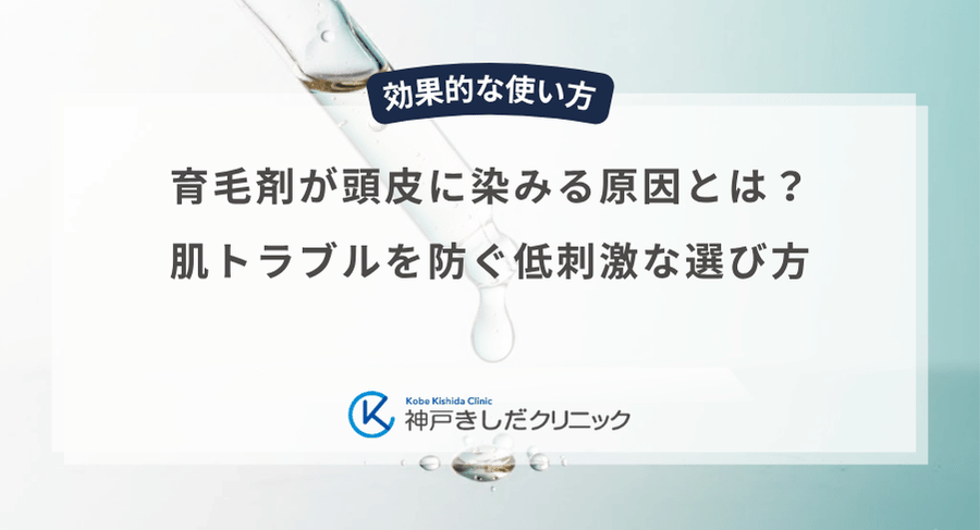 育毛剤が頭皮に染みる原因とは？肌トラブルを防ぐ低刺激な選び方