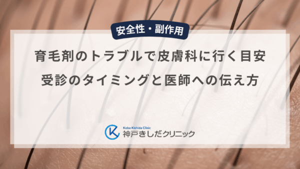 育毛剤のトラブルで皮膚科に行く目安｜受診のタイミングと医師への伝え方