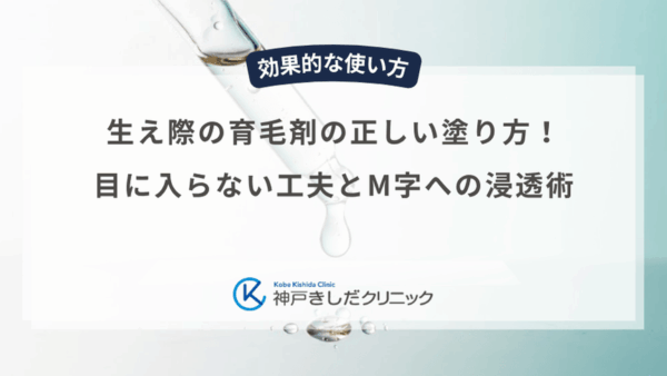 生え際の育毛剤の正しい塗り方！目に入らない工夫とM字への浸透術