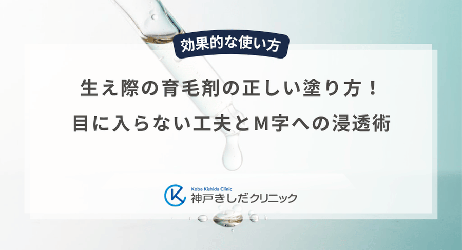 生え際の育毛剤の正しい塗り方！目に入らない工夫とM字への浸透術