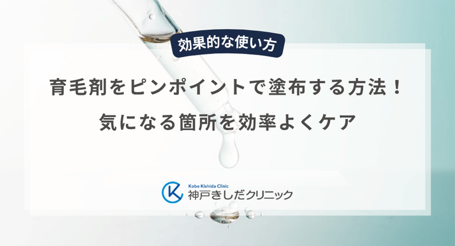 育毛剤をピンポイントで塗布する方法！気になる箇所を効率よくケア